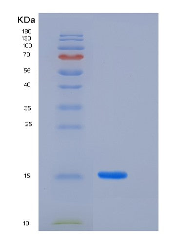 SDS-PAGE analysis of Human LAIR2 (Leukocyte-Associated Immunoglobulin-Like Receptor 2) - Recombinant Protein, showing >85% purity under 15% SDS-PAGE (Reduced)