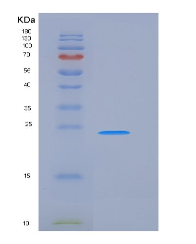 SDS-PAGE analysis of Human FCER1A (High Affinity Immunoglobulin Epsilon Receptor Subunit Alpha) - Recombinant Protein, showing >90% purity under 15% SDS-PAGE (Reduced)