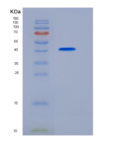 SDS-PAGE analysis of Human FCGRT (Igg Receptor Fcrn Large Subunit P51) - Recombinant Protein, CAT# BLT-08427P showing >90% purity under 15% SDS-PAGE (Reduced)