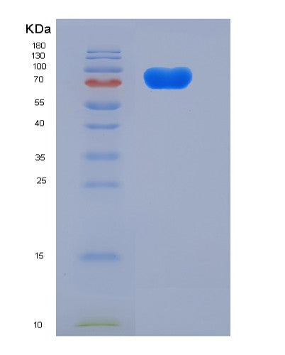 SDS-PAGE analysis of Mouse Enpp2 (Autotaxin) - Recombinant Protein, showing >85% purity under 15% SDS-PAGE (Reduced)