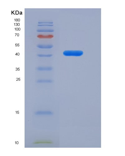 SDS-PAGE analysis of Human FCGRT (Igg Receptor Fcrn Large Subunit P51) - Recombinant Protein, CAT# BLT-08428P showing >85% purity under 15% SDS-PAGE (Reduced)