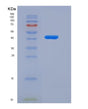 SDS-PAGE analysis of Human FCGRT (Igg Receptor Fcrn Large Subunit P51) - Recombinant Protein, CAT# BLT-08428P showing >85% purity under 15% SDS-PAGE (Reduced)