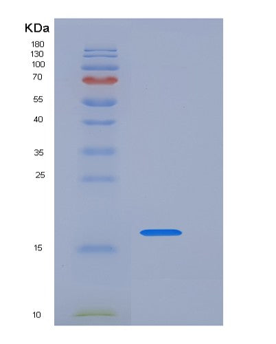 SDS-PAGE analysis of Human LAIR1 (Leukocyte-Associated Immunoglobulin-Like Receptor 1) - Recombinant Protein, showing >95% purity under 15% SDS-PAGE (Reduced)