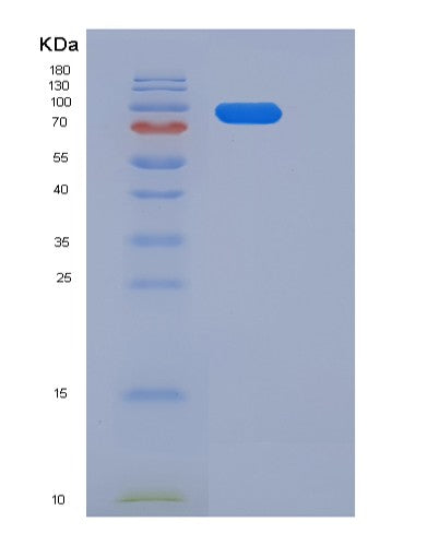 SDS-PAGE analysis of Human ERBB3 (Receptor Tyrosine-Protein Kinase Erbb-3) - Recombinant Protein, showing >85% purity under 15% SDS-PAGE (Reduced)