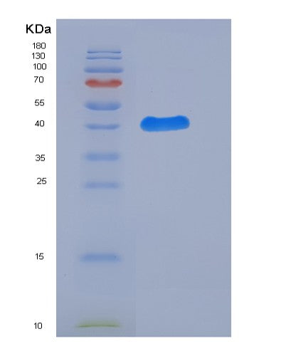 SDS-PAGE analysis of Human LGALS7 (Galectin-7) - Recombinant Protein, showing >85% purity under 15% SDS-PAGE (Reduced)
