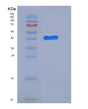 SDS-PAGE analysis of Human LGALS7 (Galectin-7) - Recombinant Protein, showing >85% purity under 15% SDS-PAGE (Reduced)
