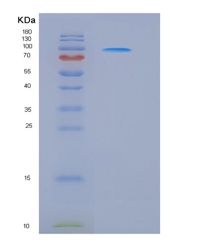 SDS-PAGE analysis of Human ERBB3 (Receptor Tyrosine-Protein Kinase Erbb-3) - Recombinant Protein, showing >95% purity under 15% SDS-PAGE (Reduced)
