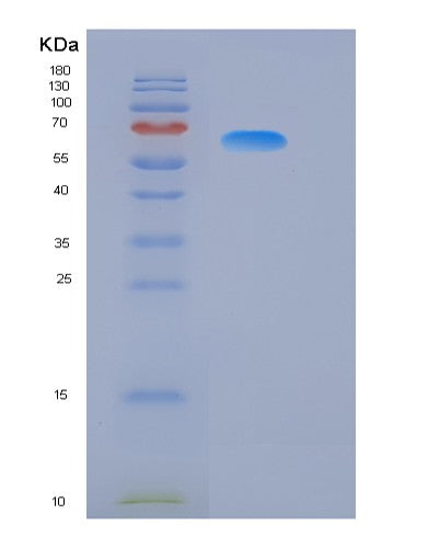 SDS-PAGE analysis of Human GPC3 (Glypican-3) - Recombinant Protein, showing >85% purity under 15% SDS-PAGE (Reduced)