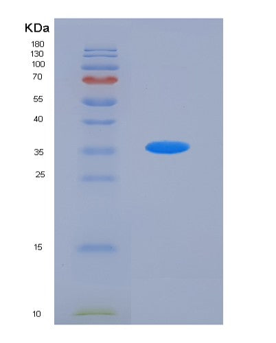 SDS-PAGE analysis of Human ACVRL1 (Activin Receptor Type-1-Like) - Recombinant Protein, showing >90% purity under 15% SDS-PAGE (Reduced)