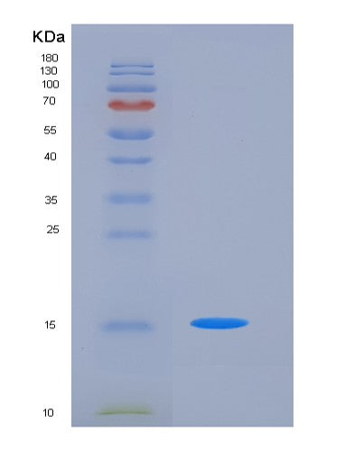 SDS-PAGE analysis of Human CD47 (Leukocyte Surface Antigen Cd47) - Recombinant Protein, showing >85% purity under 15% SDS-PAGE (Reduced)