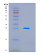 SDS-PAGE analysis of Mouse Mbl1 (Mannose-Binding Protein A) - Recombinant Protein, showing >85% purity under 15% SDS-PAGE (Reduced)