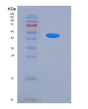 SDS-PAGE analysis of Human BACE1 (Beta-Secretase 1) - Recombinant Protein, showing >95% purity under 15% SDS-PAGE (Reduced)