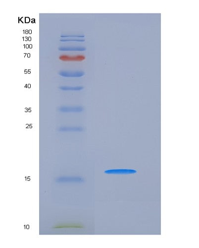 SDS-PAGE analysis of Human NPM1 (Nucleophosmin) - Recombinant Protein, showing >90% purity under 15% SDS-PAGE (Reduced)