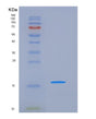 SDS-PAGE analysis of Human NPM1 (Nucleophosmin) - Recombinant Protein, showing >90% purity under 15% SDS-PAGE (Reduced)