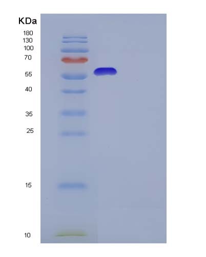 SDS-PAGE analysis of Human IL13RA2 (Interleukin-13 Receptor Subunit Alpha-2) - Recombinant Protein, showing >95% purity under 15% SDS-PAGE (Reduced)