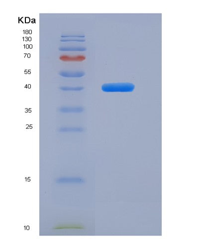 SDS-PAGE analysis of Human MUC1 (Mucin-1) - Recombinant Protein, showing >95% purity under 15% SDS-PAGE (Reduced)