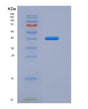 SDS-PAGE analysis of Human MUC1 (Mucin-1) - Recombinant Protein, showing >95% purity under 15% SDS-PAGE (Reduced)