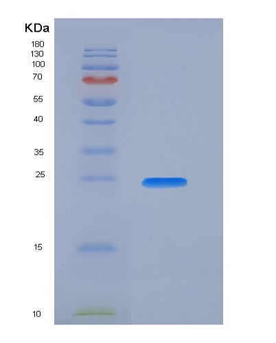 SDS-PAGE analysis of Human KLK4 (Kallikrein-4) - Recombinant Protein, showing >90% purity under 15% SDS-PAGE (Reduced)