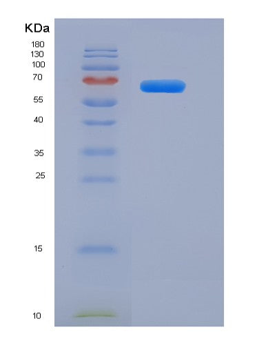 SDS-PAGE analysis of Human FGFR2 (Fibroblast Growth Factor Receptor 2) - Recombinant Protein, showing >95% purity under 15% SDS-PAGE (Reduced)