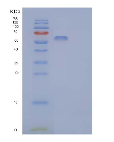 SDS-PAGE analysis of Human CDC123 (Translation Initiation Factor Eif2 Assembly Protein) - Recombinant Protein, showing >95% purity under 15% SDS-PAGE (Reduced)