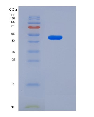 SDS-PAGE analysis of Mouse Cxadr (Coxsackievirus And Adenovirus Receptor Homolog) - Recombinant Protein, showing >95% purity under 15% SDS-PAGE (Reduced)