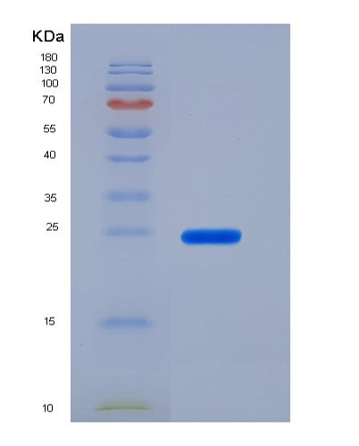 SDS-PAGE analysis of Mouse Slamf8 (Slam Family Member 8) - Recombinant Protein, showing >85% purity under 15% SDS-PAGE (Reduced)