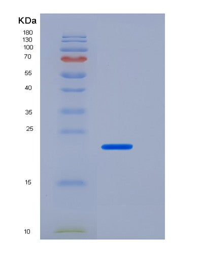 SDS-PAGE analysis of Human FTH1 (Ferritin Heavy Chain) - Recombinant Protein, showing >90% purity under 15% SDS-PAGE (Reduced)