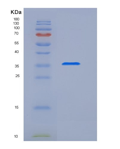 SDS-PAGE analysis of Human S100B (Protein S100-B) - Recombinant Protein, showing >95% purity under 15% SDS-PAGE (Reduced)