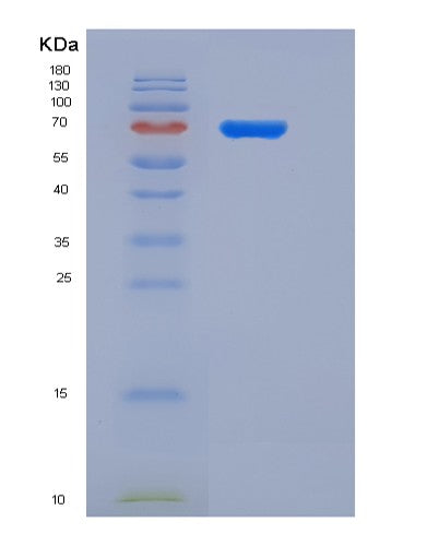 SDS-PAGE analysis of Human SEMA4A (Semaphorin-4A) - Recombinant Protein, showing >85% purity under 15% SDS-PAGE (Reduced)