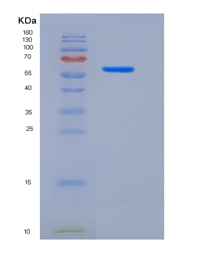 SDS-PAGE analysis of Human MST1R (Macrophage-Stimulating Protein Receptor) - Recombinant Protein, showing >95% purity under 15% SDS-PAGE (Reduced)