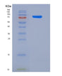 SDS-PAGE analysis of Human DSC2 (Desmocollin-2) - Recombinant Protein, showing >90% purity under 15% SDS-PAGE (Reduced)