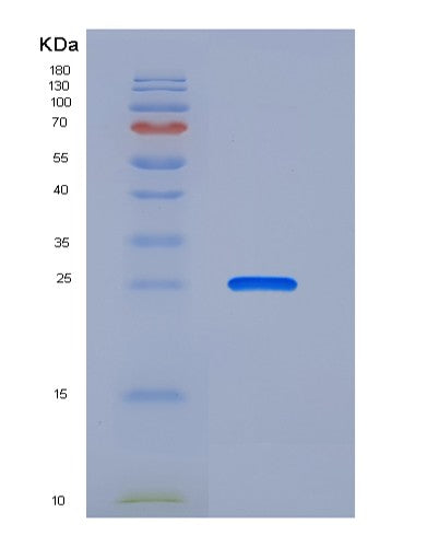 SDS-PAGE analysis of Human FCAR (Immunoglobulin Alpha Fc Receptor) - Recombinant Protein, showing >85% purity under 15% SDS-PAGE (Reduced)