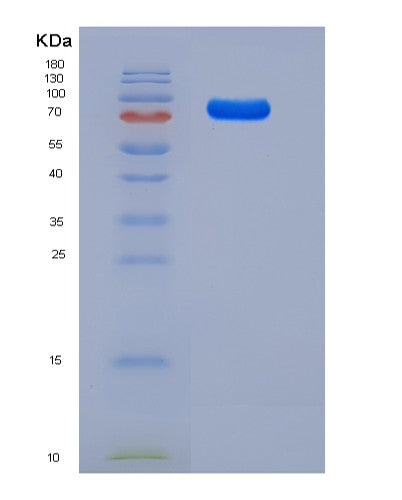 SDS-PAGE analysis of Human FLT4 (Vascular Endothelial Growth Factor Receptor 3) - Recombinant Protein, showing >85% purity under 15% SDS-PAGE (Reduced)