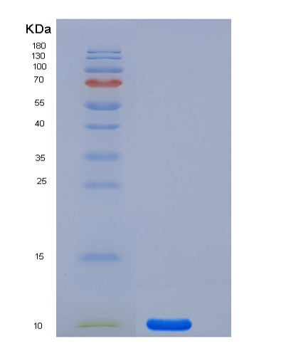 SDS-PAGE analysis of Human S100A1 (Protein S100-A1) - Recombinant Protein, showing >95% purity under 15% SDS-PAGE (Reduced)