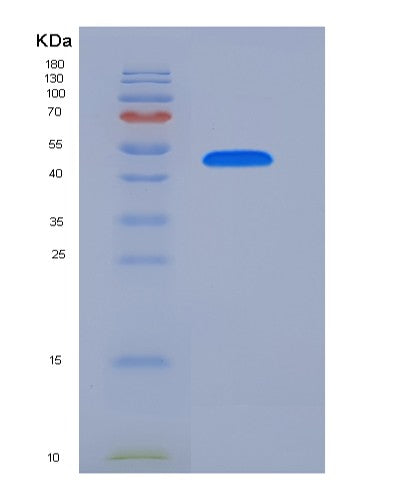 SDS-PAGE analysis of Mouse Igfbp7 (Insulin-Like Growth Factor-Binding Protein 7) - Recombinant Protein, showing >90% purity under 15% SDS-PAGE (Reduced)