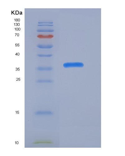SDS-PAGE analysis of Human S100A1 (Protein S100-A1) - Recombinant Protein, showing >95% purity under 15% SDS-PAGE (Reduced)
