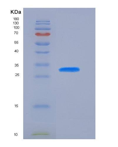 SDS-PAGE analysis of Human PTH (Parathyroid Hormone) - Recombinant Protein, showing >95% purity under 15% SDS-PAGE (Reduced)