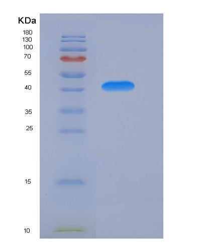 SDS-PAGE analysis of Mouse Ntrk1 (High Affinity Nerve Growth Factor Receptor) - Recombinant Protein, showing >90% purity under 15% SDS-PAGE (Reduced)