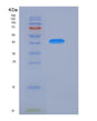 SDS-PAGE analysis of Mouse Ntrk1 (High Affinity Nerve Growth Factor Receptor) - Recombinant Protein, showing >90% purity under 15% SDS-PAGE (Reduced)