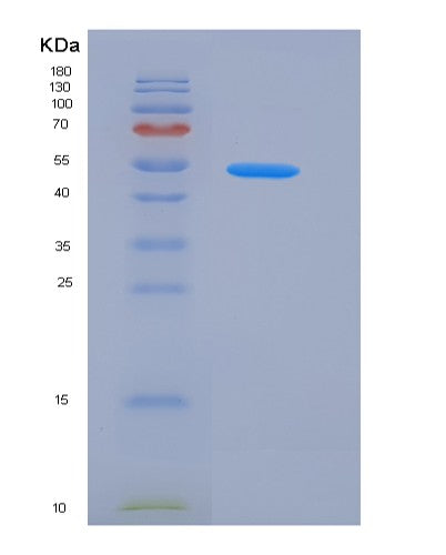 SDS-PAGE analysis of Human CXADR (Coxsackievirus And Adenovirus Receptor) - Recombinant Protein, showing >95% purity under 15% SDS-PAGE (Reduced)
