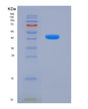 SDS-PAGE analysis of Mouse Ly96 (Lymphocyte Antigen 96) - Recombinant Protein, showing >85% purity under 15% SDS-PAGE (Reduced)