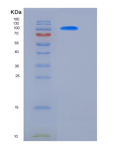 SDS-PAGE analysis of Mouse Ctnnb1 (Catenin Beta-1) - Recombinant Protein, showing >85% purity under 15% SDS-PAGE (Reduced)