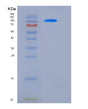 SDS-PAGE analysis of Mouse Ctnnb1 (Catenin Beta-1) - Recombinant Protein, showing >85% purity under 15% SDS-PAGE (Reduced)