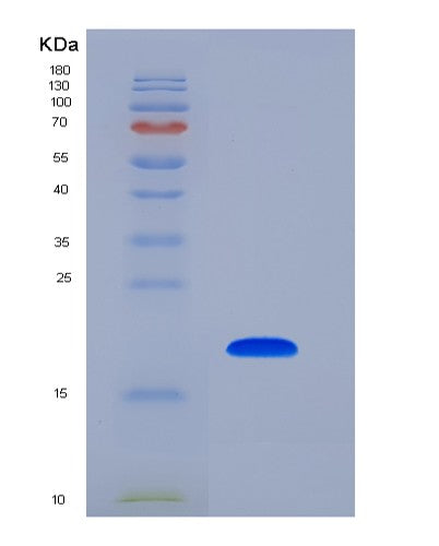 SDS-PAGE analysis of Human LCN1 (Lipocalin-1) - Recombinant Protein, showing >90% purity under 15% SDS-PAGE (Reduced)