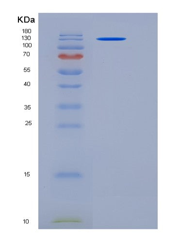 SDS-PAGE analysis of Human CNTN3 (Contactin-3) - Recombinant Protein, showing >95% purity under 15% SDS-PAGE (Reduced)