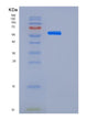 SDS-PAGE analysis of Human EPHB2 (Ephrin Type-B Receptor 2) - Recombinant Protein, showing >90% purity under 15% SDS-PAGE (Reduced)