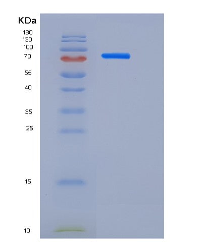 SDS-PAGE analysis of Human DLL4 (Delta-Like Protein 4) - Recombinant Protein, showing >85% purity under 15% SDS-PAGE (Reduced)