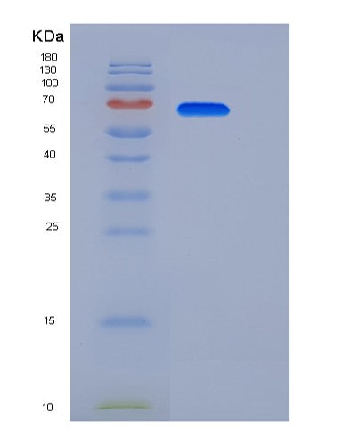 SDS-PAGE analysis of Human EPHA7 (Ephrin Type-A Receptor 7) - Recombinant Protein, showing >90% purity under 15% SDS-PAGE (Reduced)