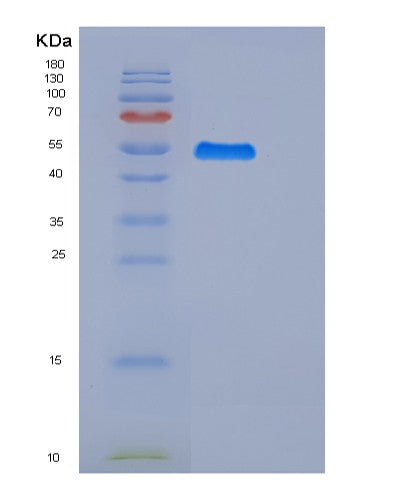SDS-PAGE analysis of Human VTCN1 (V-Set Domain-Containing T-Cell Activation Inhibitor 1) - Recombinant Protein, showing >85% purity under 15% SDS-PAGE (Reduced)