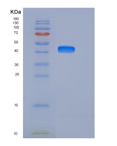 SDS-PAGE analysis of Human DDR1 (Epithelial Discoidin Domain-Containing Receptor 1) - Recombinant Protein, showing >90% purity under 15% SDS-PAGE (Reduced)